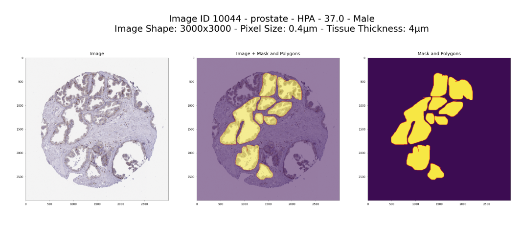 image of FTU dataset